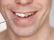 En İyi Ağız Duşu